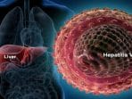 gejala hepatitis akut dan cara mencegahnya ditetapkan who sebagai kejadian luar biasa 369446b